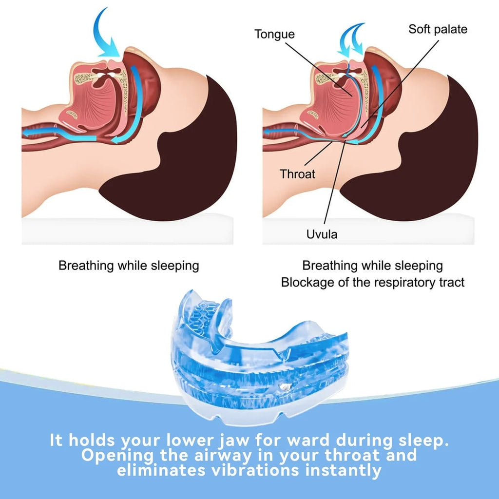 Adjustable Snoring Mouth Guard with Anti Device Screwdriver and Storage Case - Image 3